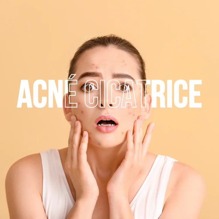 skincare coréenne acné